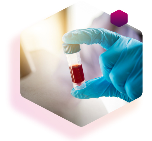 Laborassistent misst Langzeitblutzuckerwert (HbA1c-Wert) Laborassistent misst Langzeitblutzuckerwert (HbA1c-Wert)