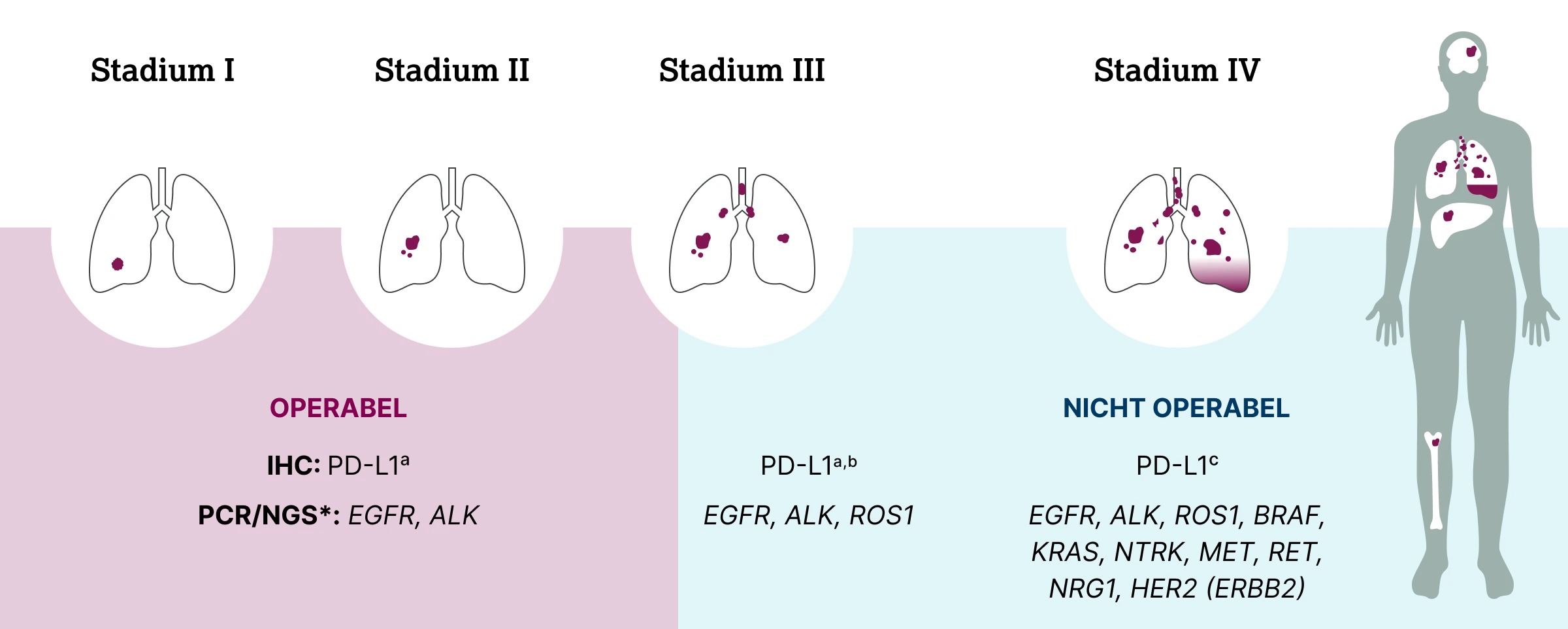 1.2.3-05-tumorerkrankungen-PD-L1-Lunge-grafik-empfehlungen-biomarkerdiagnostik-2x.webp 1.2.3-05-tumorerkrankungen-PD-L1-Lunge-grafik-empfehlungen-biomarkerdiagnostik-2x.webp