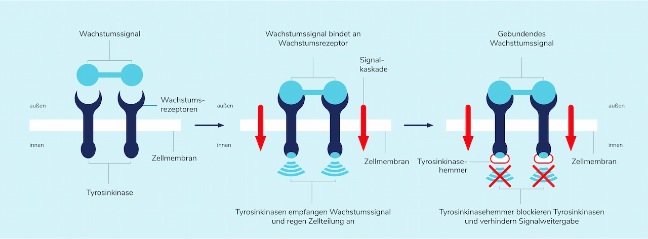 03-05_Tyrosinkinase-Hemmer.webp