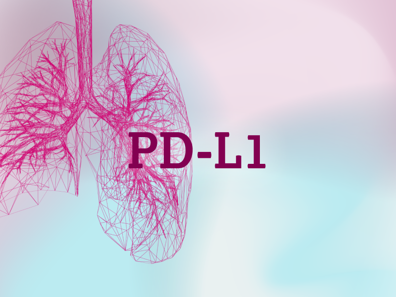 teaser-lung-ebene-2-PDL1-2x_uid_69d4f9b6a51cd.webp teaser-lung-ebene-2-PDL1-2x_uid_69d4f9b6a51cd.webp