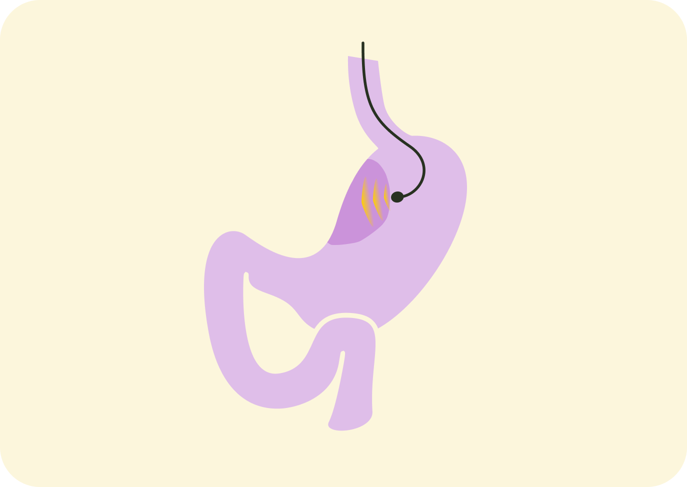 260609_01_diagnose_EUS.png 260609_01_diagnose_EUS.png