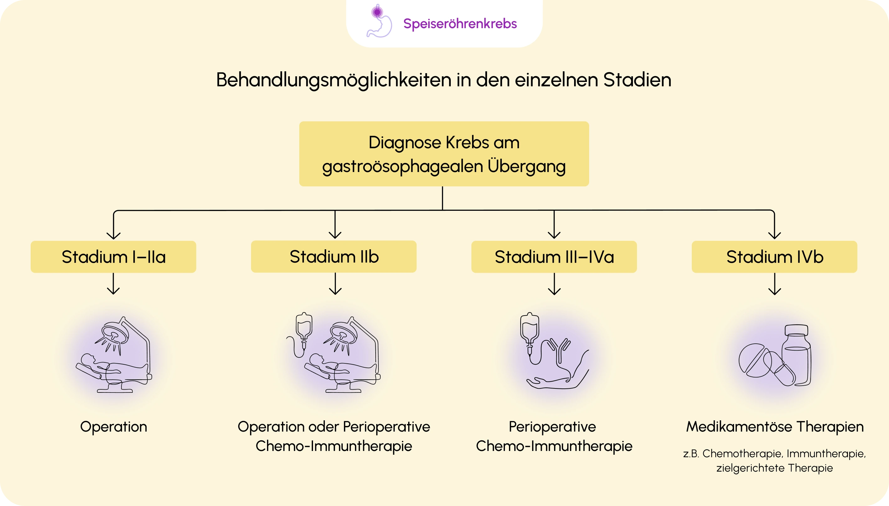 260610_02_behandlung_ueberblick-der-behandlungsmoglichkeiten-gastrooesophagealen-uebergang-v2.webp 260610_02_behandlung_ueberblick-der-behandlungsmoglichkeiten-gastrooesophagealen-uebergang-v2.webp