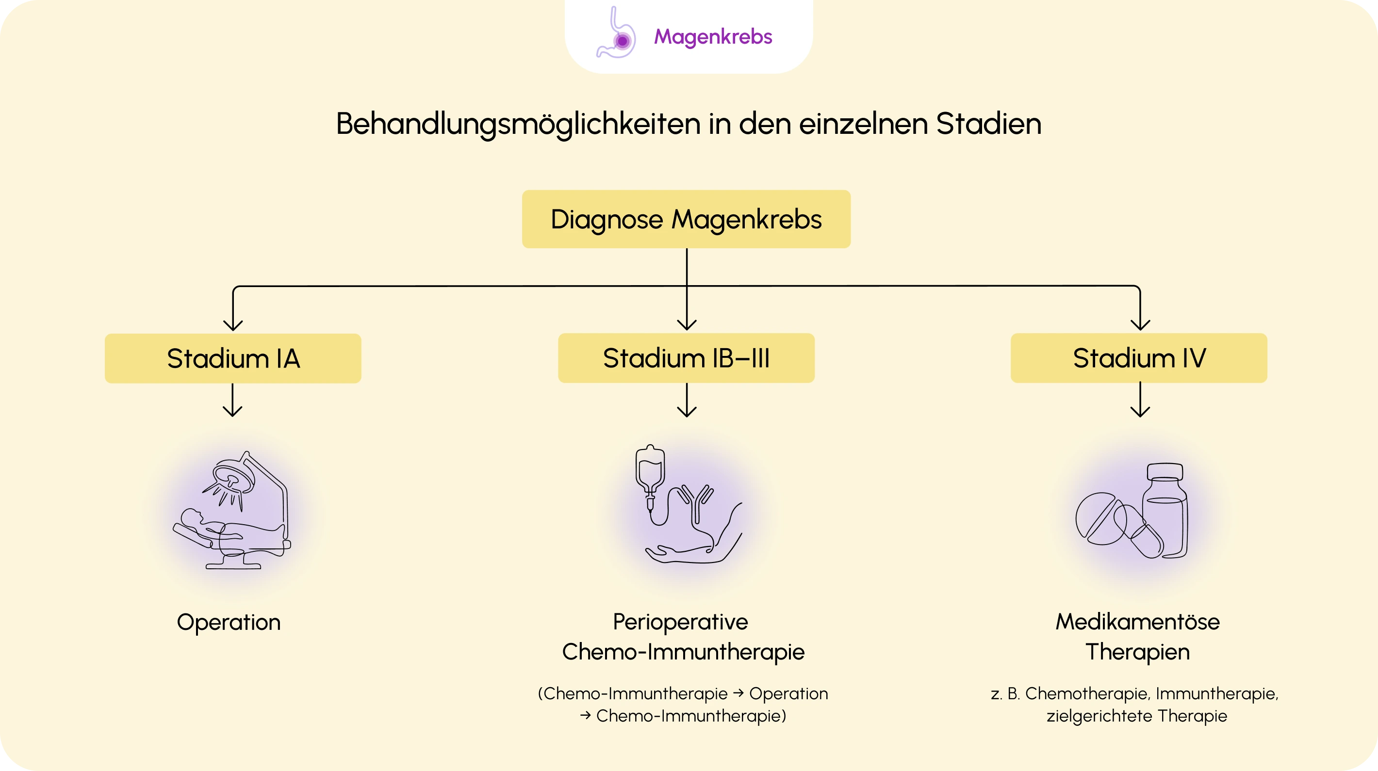 260610_02_behandlung_ueberblick-der-behandlungsmoglichkeiten-magenkrebs-v1-1.webp 260610_02_behandlung_ueberblick-der-behandlungsmoglichkeiten-magenkrebs-v1-1.webp