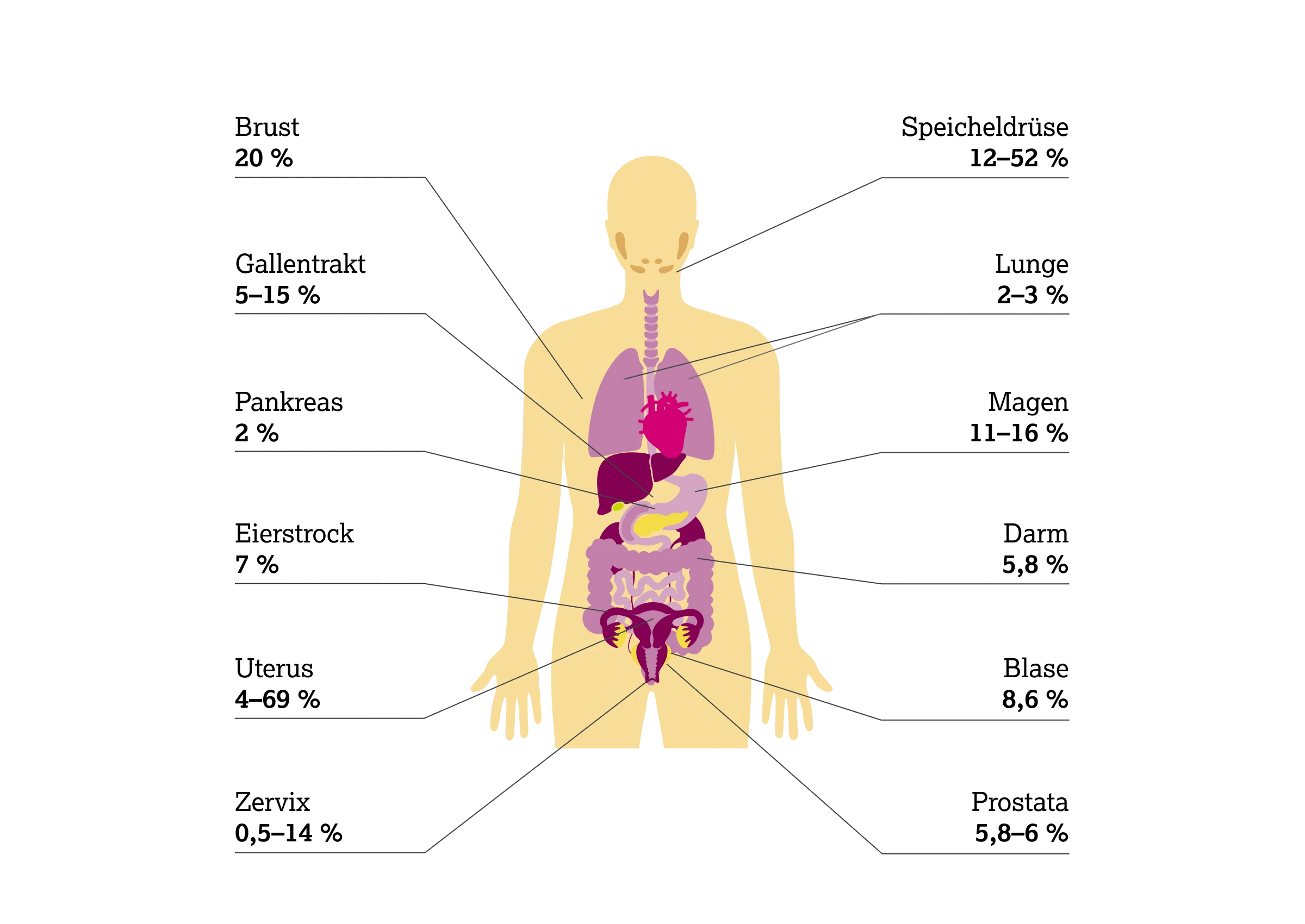 2.2.2-01-biomarker-HER2-grafik-praevalenz-amplifikation2x.webp 2.2.2-01-biomarker-HER2-grafik-praevalenz-amplifikation2x.webp