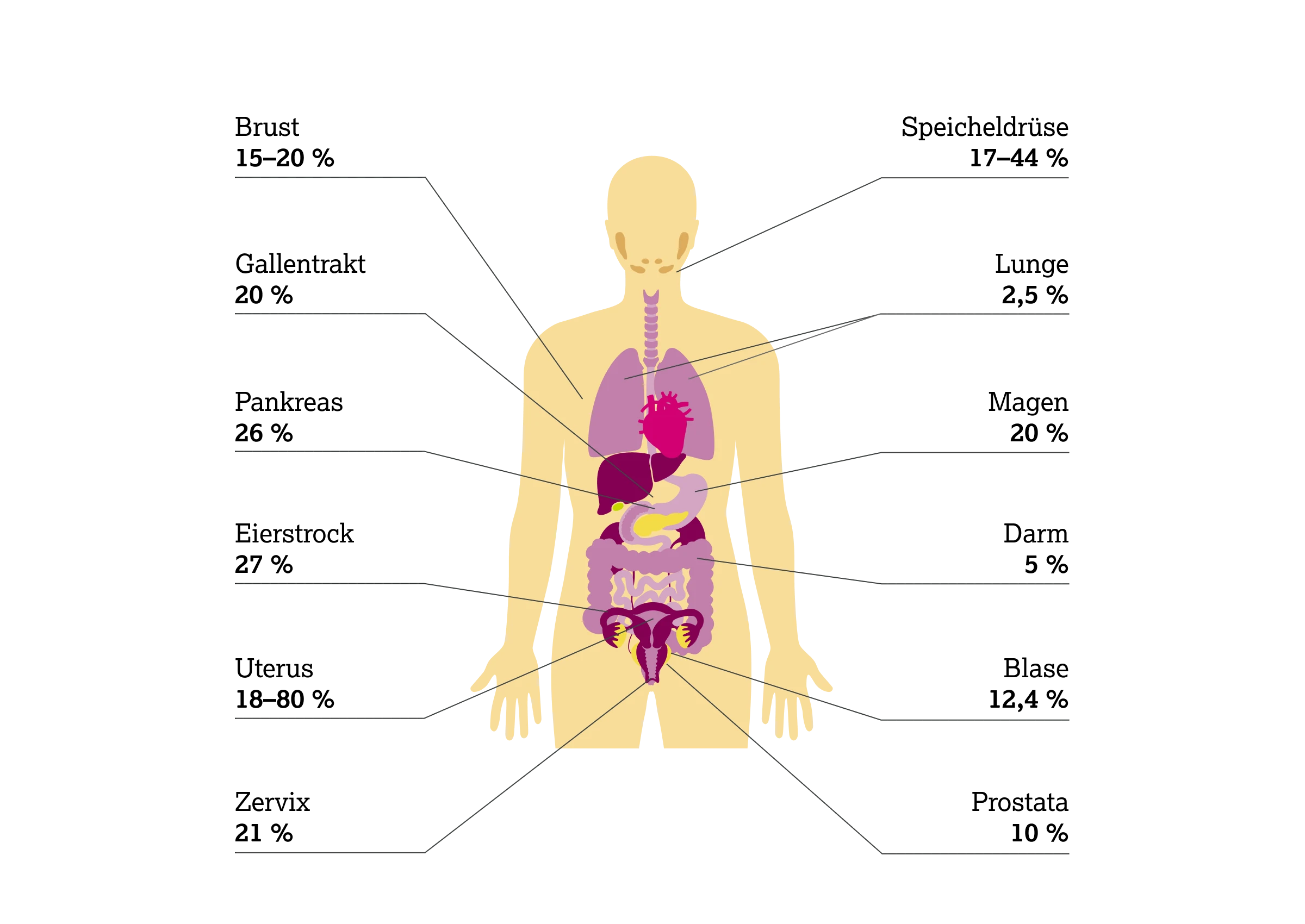 2.2.2-01-biomarker-HER2-grafik-praevalenz-ueberexpression2x.webp 2.2.2-01-biomarker-HER2-grafik-praevalenz-ueberexpression2x.webp