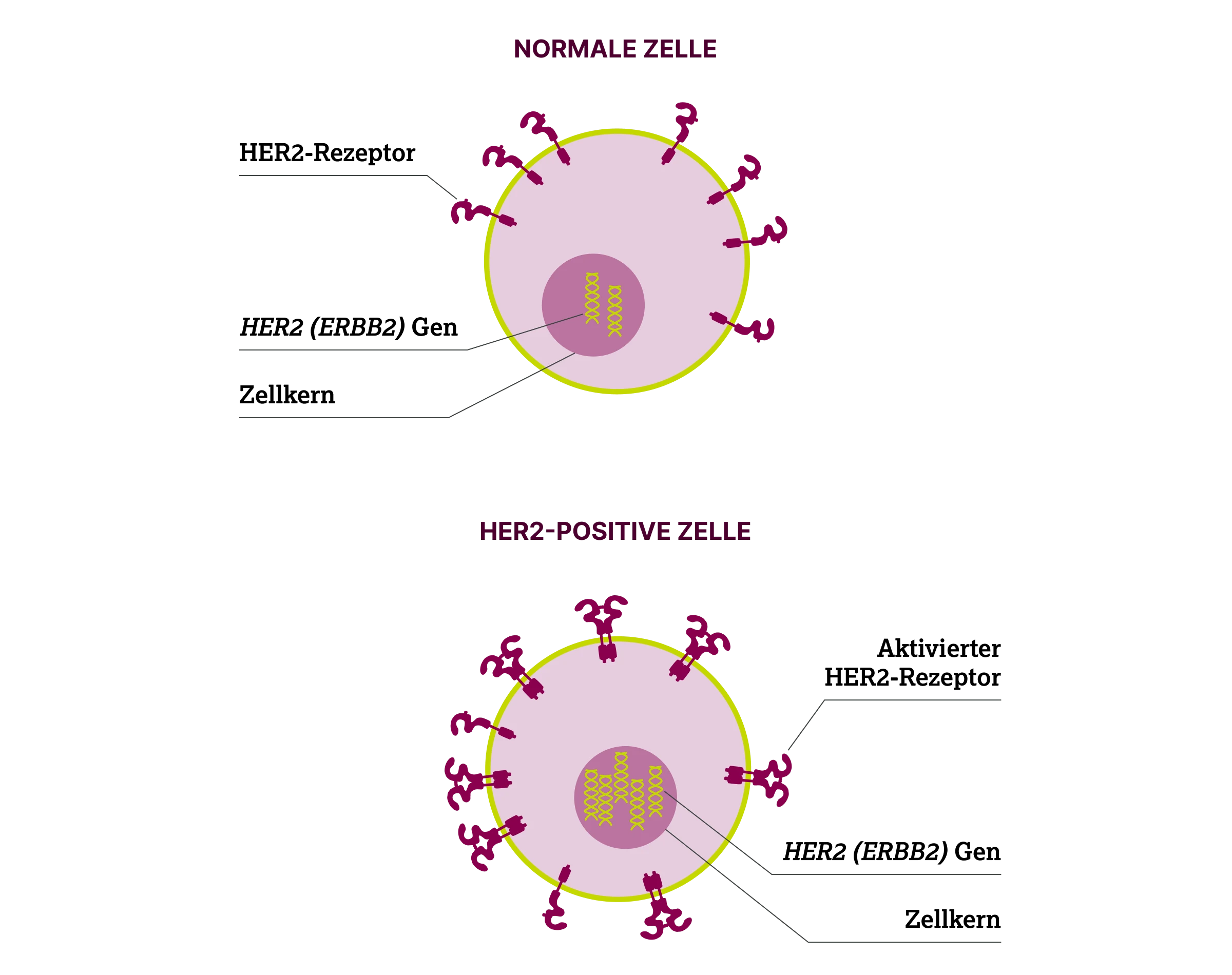 2.2.2-02-biomarker-HER2-grafik-expression-normale-zelle-tumorzelle2x.webp 2.2.2-02-biomarker-HER2-grafik-expression-normale-zelle-tumorzelle2x.webp
