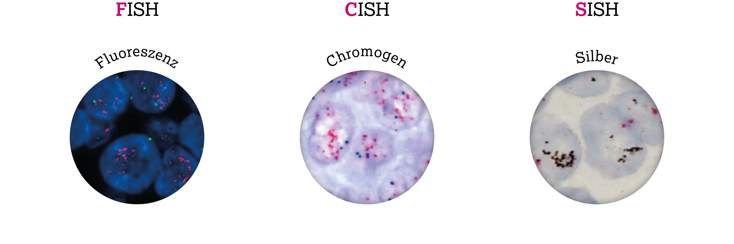 3.2.1-02-diagnostik-therapie-HER2-grafik-In-situ-Hybridisierungs-Verfahren2x.webp 3.2.1-02-diagnostik-therapie-HER2-grafik-In-situ-Hybridisierungs-Verfahren2x.webp