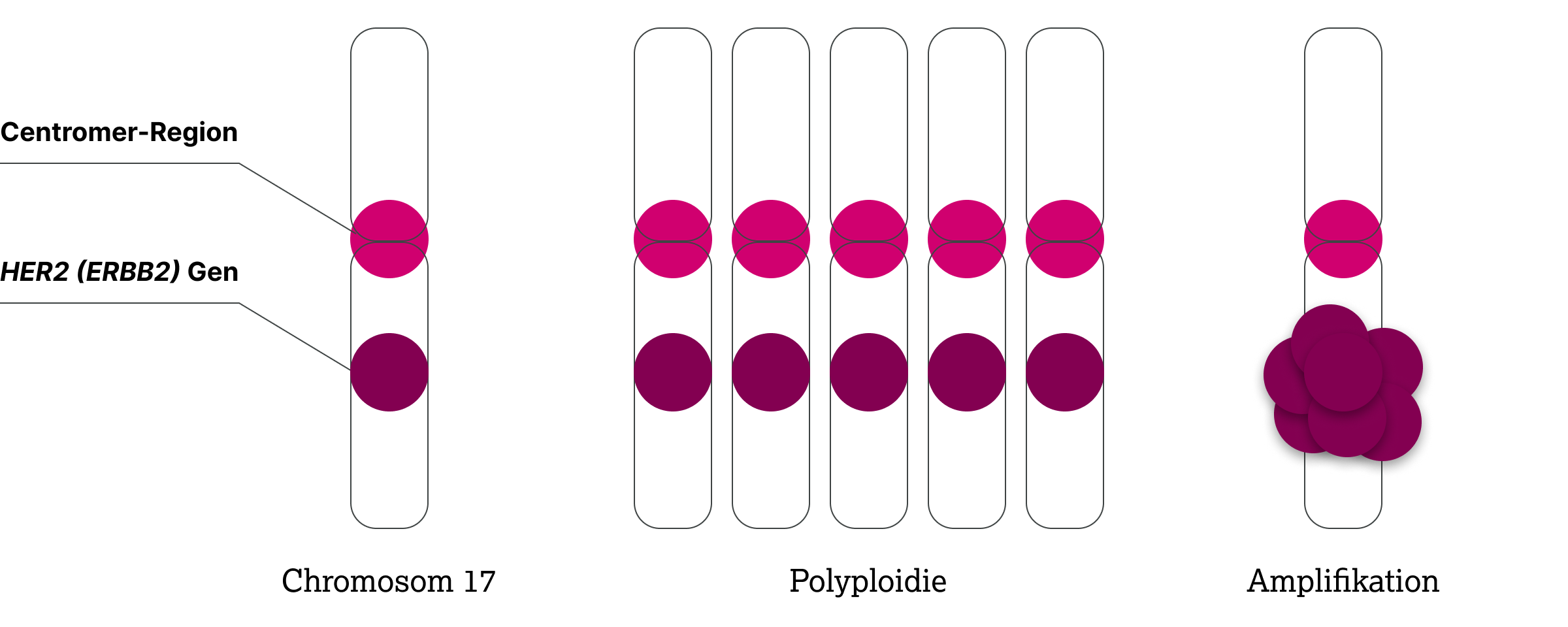 3.2.1-04-diagnostik-therapie-HER2-grafik-ISH-Dual-Sonden-2.webp 3.2.1-04-diagnostik-therapie-HER2-grafik-ISH-Dual-Sonden-2.webp
