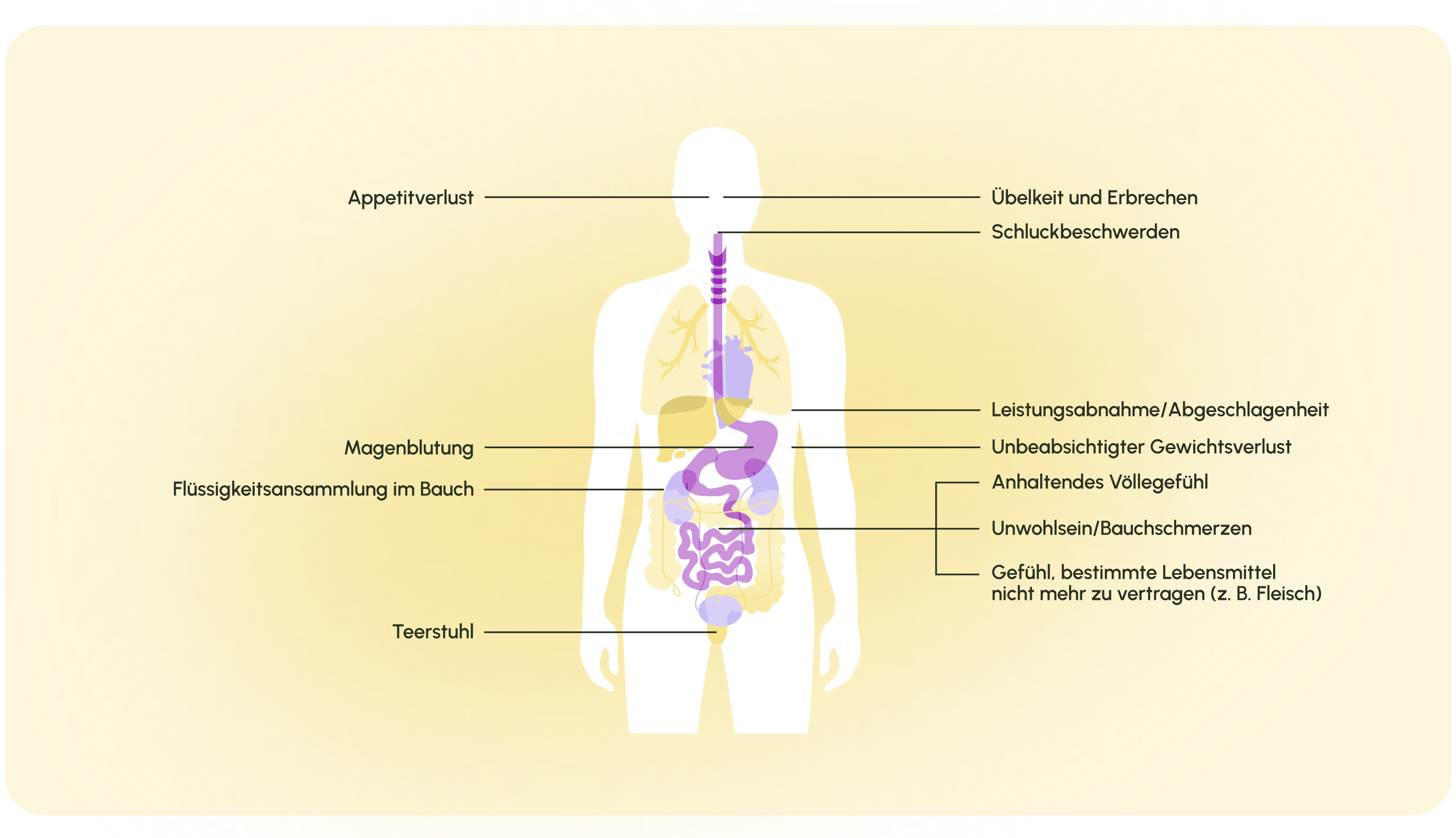 260609_01_symptome_anzeichen-magenkrebs-1.png 260609_01_symptome_anzeichen-magenkrebs-1.png