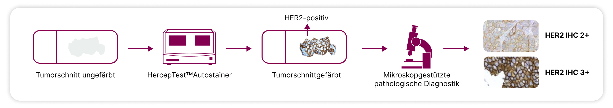 3.2.5-03-HER2-Testung-DESTINY-PanTumor-Studie.webp 3.2.5-03-HER2-Testung-DESTINY-PanTumor-Studie.webp