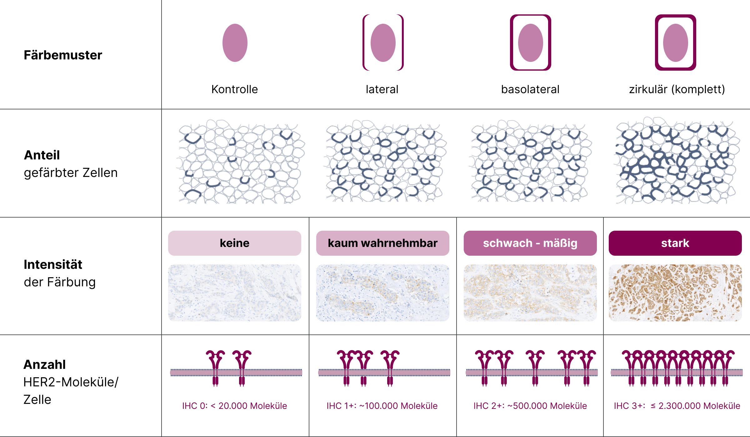 5.3.2-03-HER2-IHC-Scoring-Zentrale-Kriterien.webp 5.3.2-03-HER2-IHC-Scoring-Zentrale-Kriterien.webp