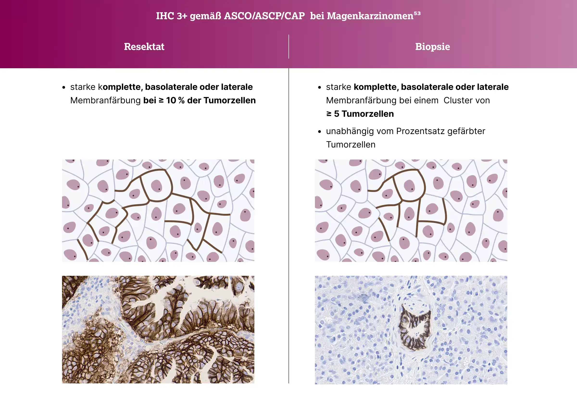 532-01-IHC-3gema-ASCO-ASCP-CAP.webp 532-01-IHC-3gema-ASCO-ASCP-CAP.webp
