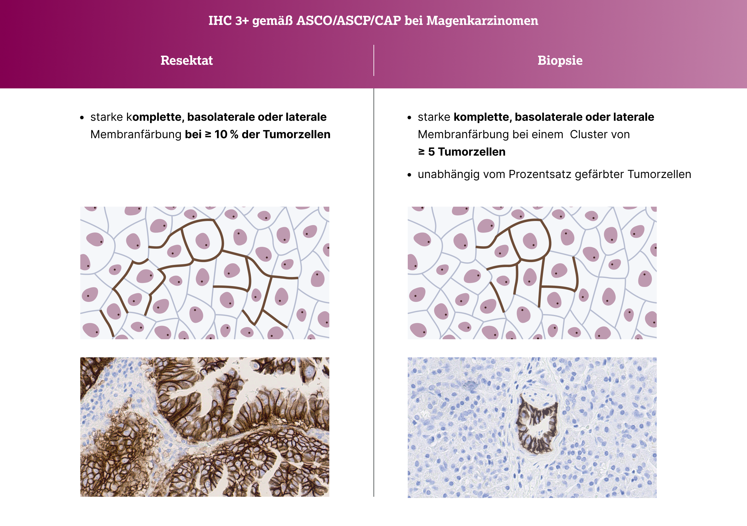 3.2.5-04-IHC-3gema-ASCO-ASCP-CAP2x.webp 3.2.5-04-IHC-3gema-ASCO-ASCP-CAP2x.webp