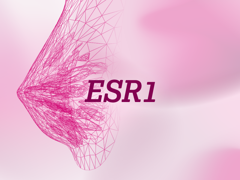 teaser-mamma-ebene-2-ESR1_uid_6a9815a4ce46c.webp teaser-mamma-ebene-2-ESR1_uid_6a9815a4ce46c.webp